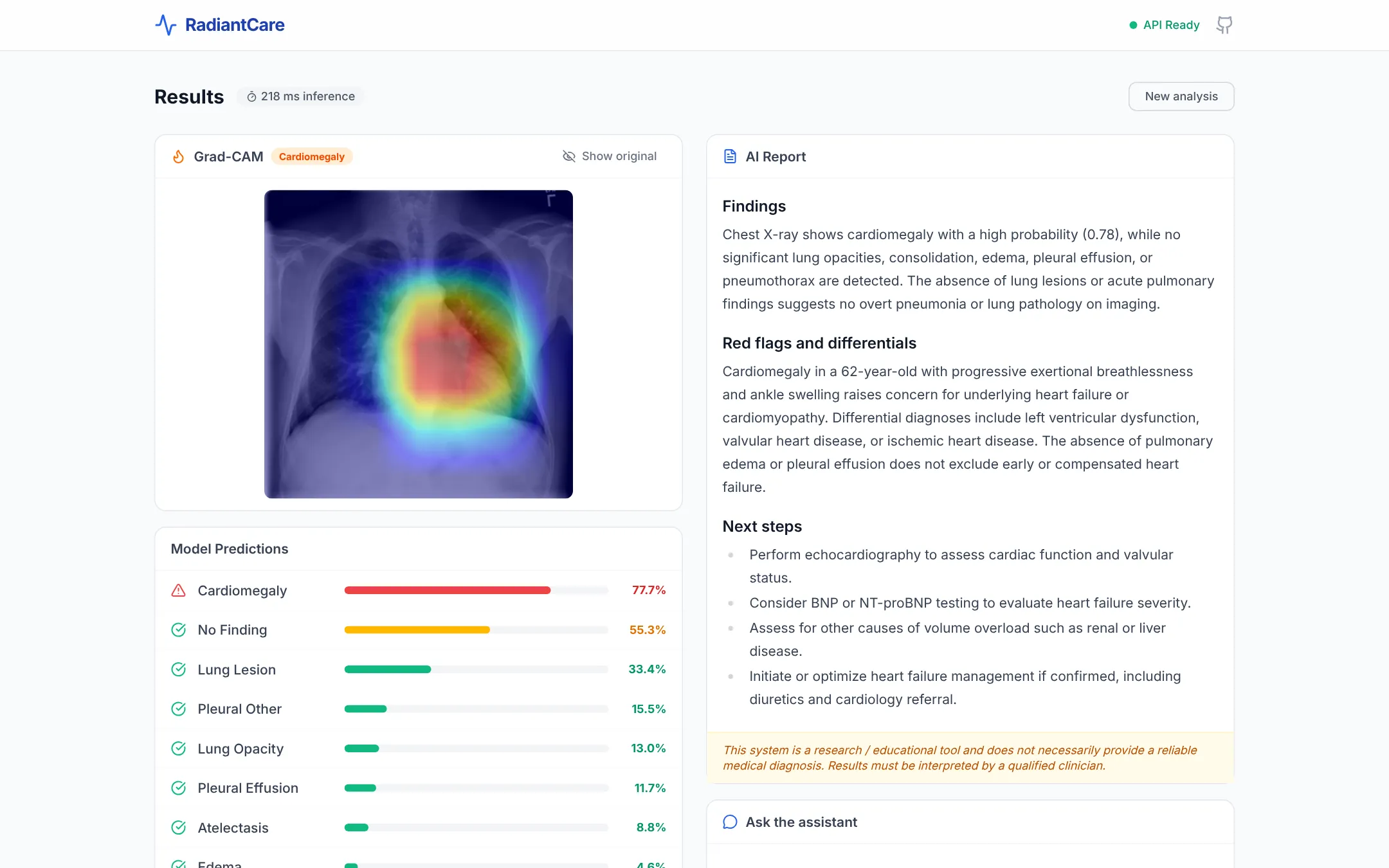 RadiantCare results: Grad-CAM heatmap, model predictions and the AI report